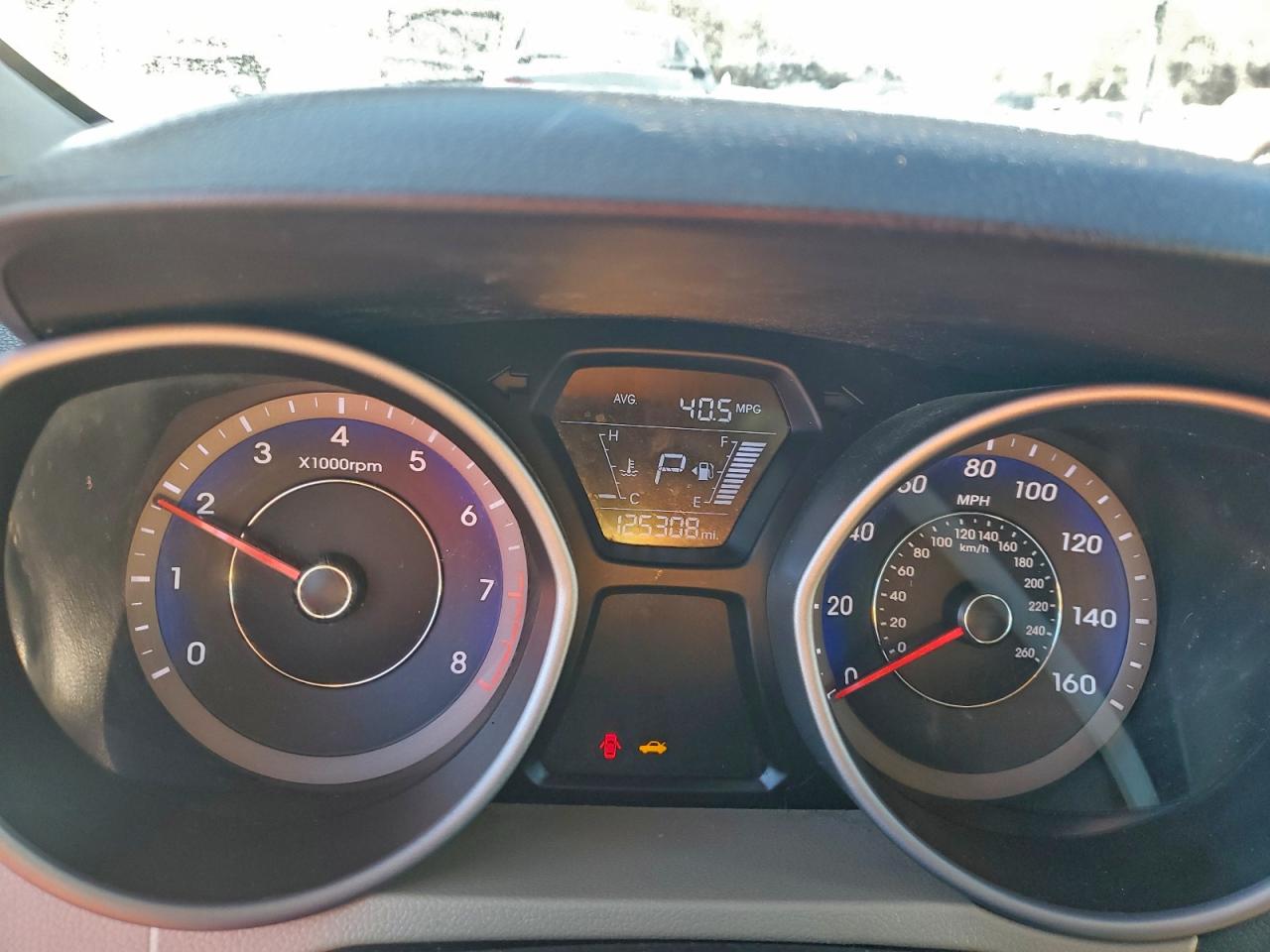 Hyundai ELANTRA Se Image 4